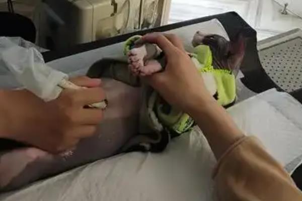 无毛猫一直打喷嚏的原因，感冒、猫鼻支、鼻子痒等因素都会导致