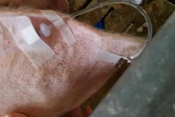 猪腹泻怎么治疗，体内有寄生虫可饲喂阿苯达唑等驱虫药