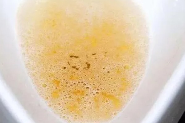 淘米水如何自制多肉肥，装瓶量控制在总容量的70%