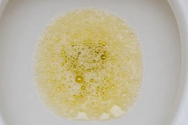 淘米水如何自制多肉肥，装瓶量控制在总容量的70%