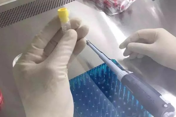 人工配牛操作方法,按以下步骤逐一进行